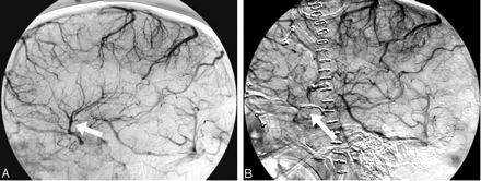 Fig 2.