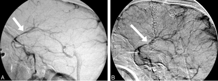 Fig 3.