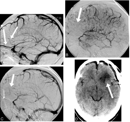 Fig 5.