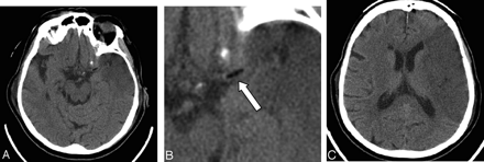 Fig 1.