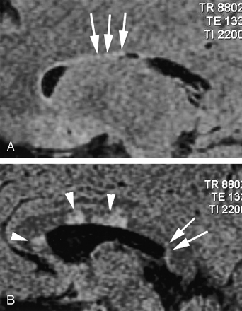 Fig 3.