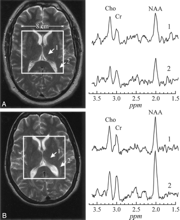 Fig 2.
