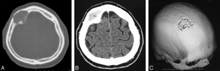 Fig 2.