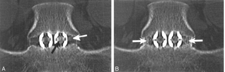 Fig 2.