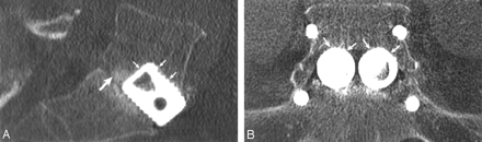 Fig 3.