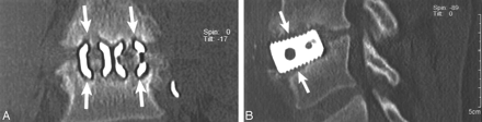 Fig 4.