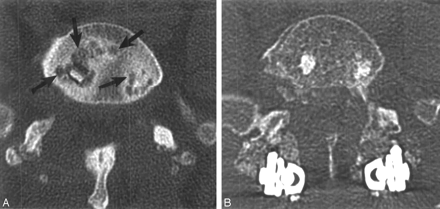 Fig 6.
