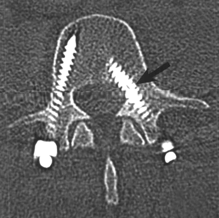 Fig 8.
