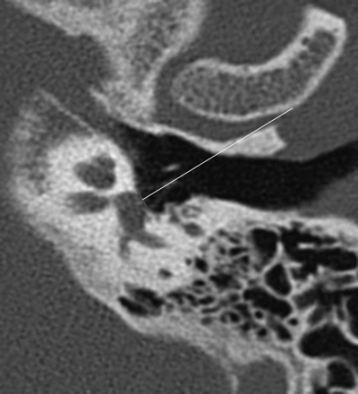 Fig 3.