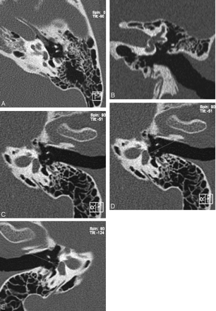 Fig 4.