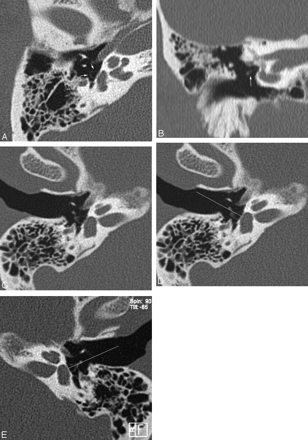 Fig 5.