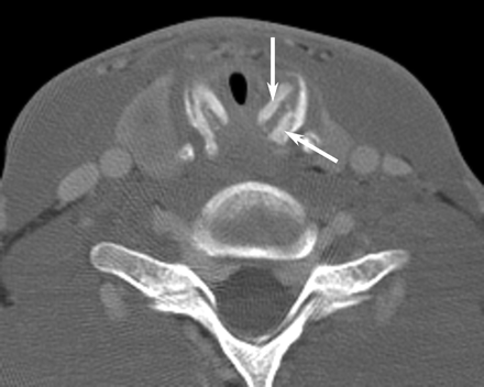 Fig 1.