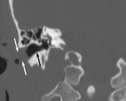 Fig 3.
