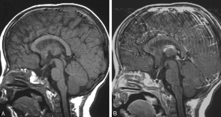 Fig 1.