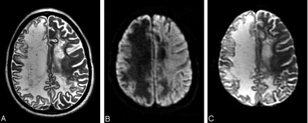 Fig 2.