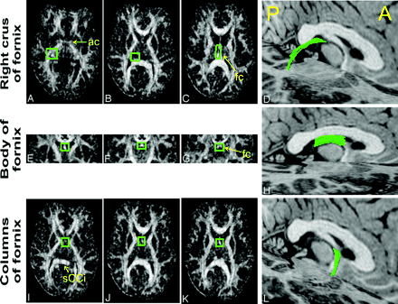 Fig 2.
