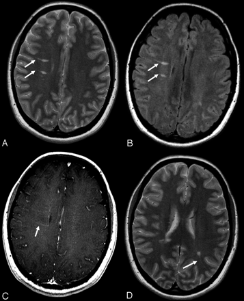 Fig 1.