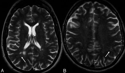 Fig 2.