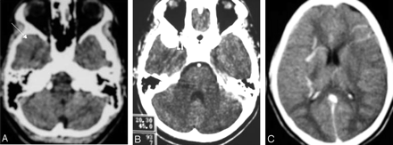 Fig 1.