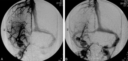 Fig 3.