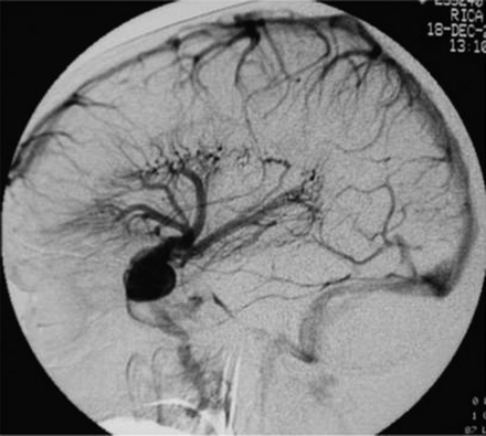 Fig 4.