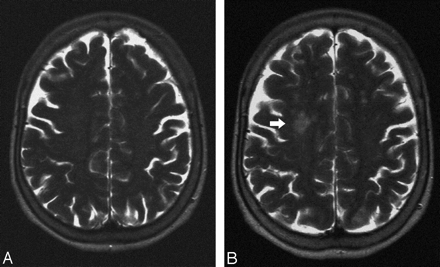 Fig 2.