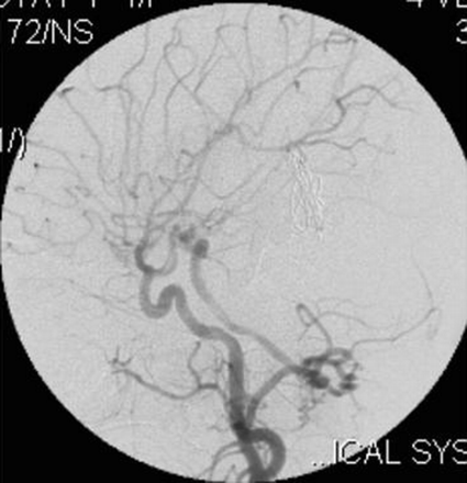 Fig 10.