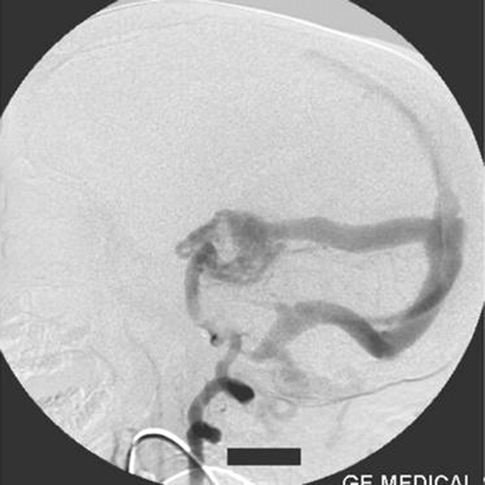 Fig 2.