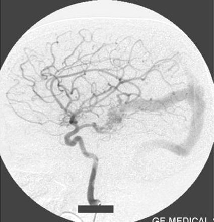 Fig 3.