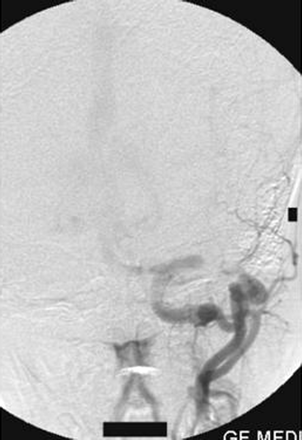 Fig 9.