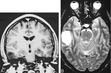 Fig 1.