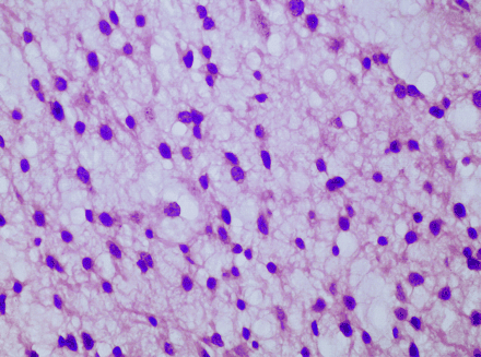 Fig 2.