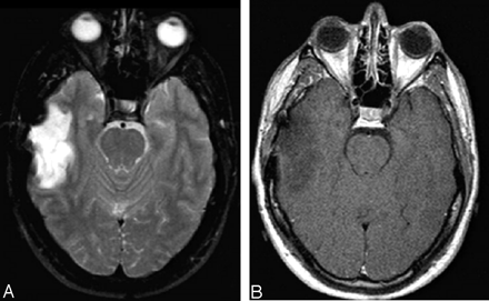 Fig 3.
