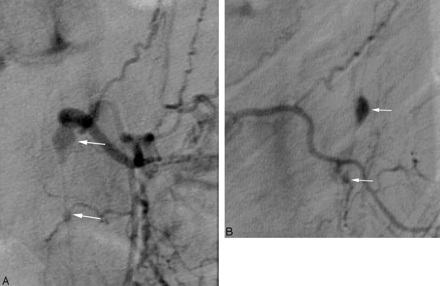 Fig 2.