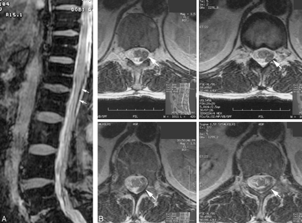 Fig 3.