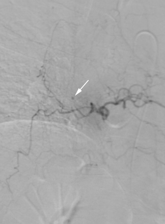 Fig 5.