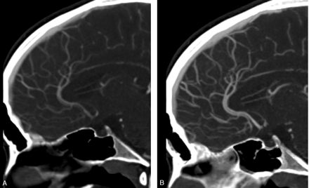 Fig 2.