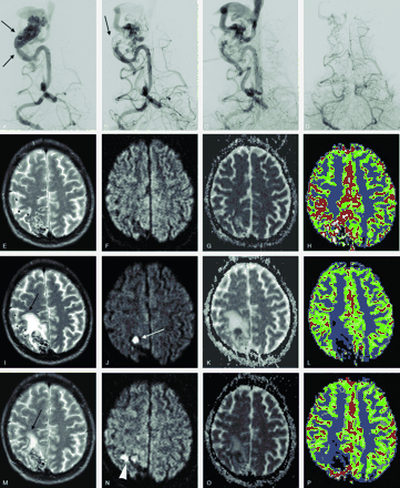 Fig 5.
