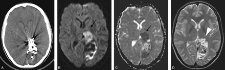 Fig 6.