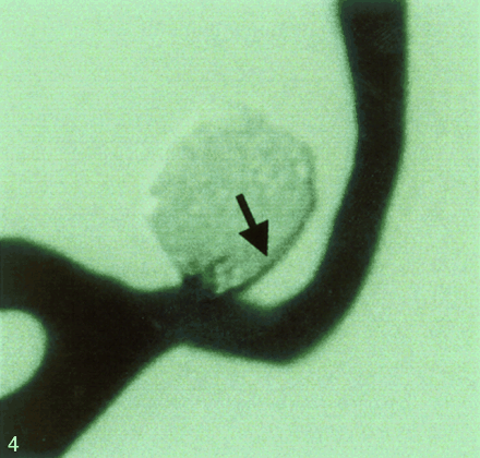Fig 4.