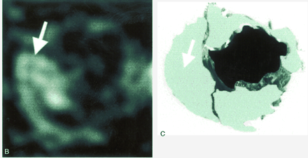 Fig 5.