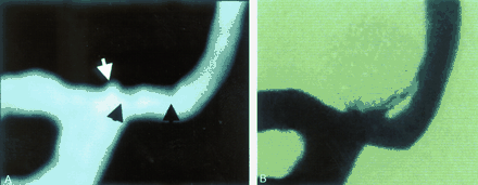 Fig 7.