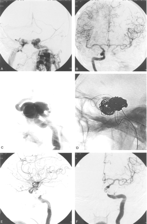 Fig 1.