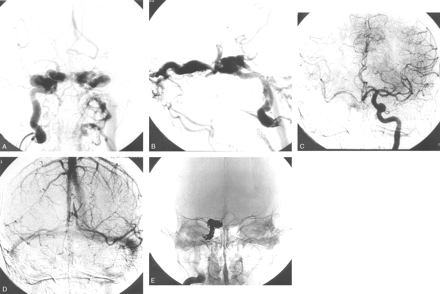 Fig 2.