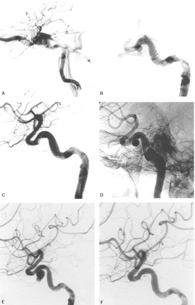 Fig 3.