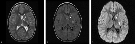 Fig 2.