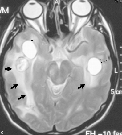 Fig 1.