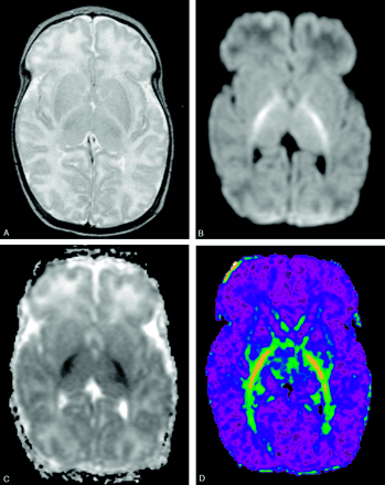 Fig 1.
