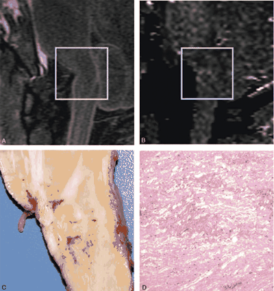 Fig 2.