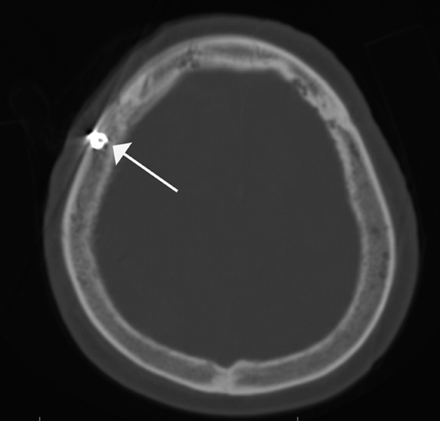 Fig 2.